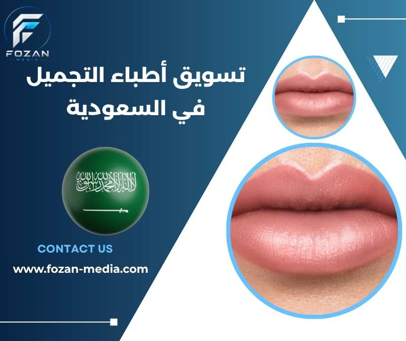 تسويق أطباء التجميل في السعودية
