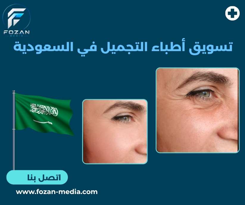 تسويق أطباء التجميل في السعودية