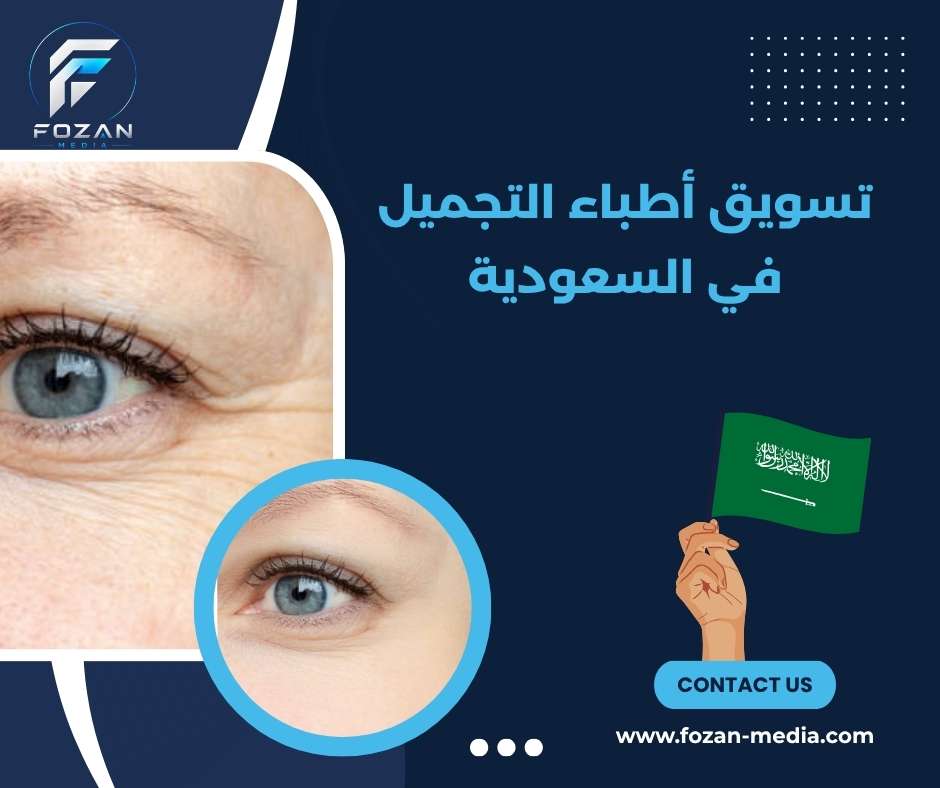 تسويق أطباء التجميل في السعودية