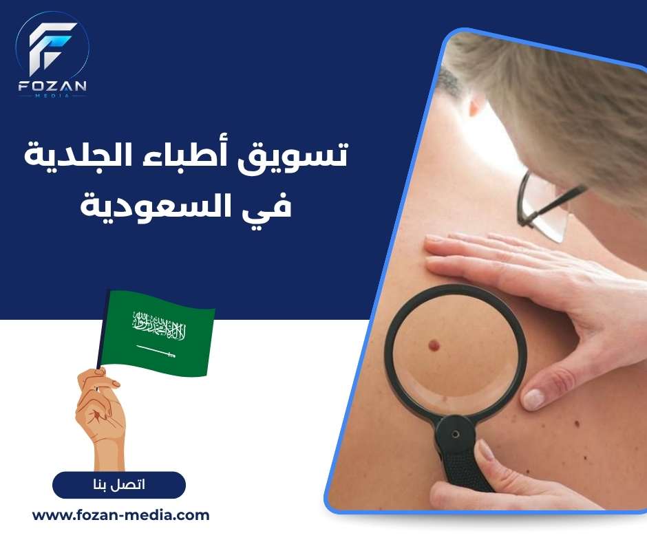 تسويق أطباء الجلدية في السعودية