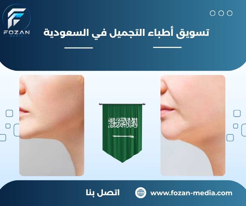 تسويق أطباء التجميل في السعودية