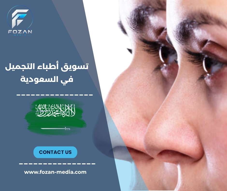 تسويق أطباء التجميل في السعودية