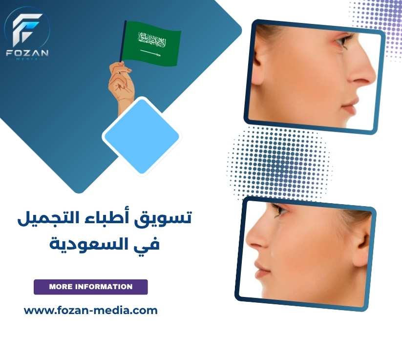 تسويق أطباء التجميل في السعودية