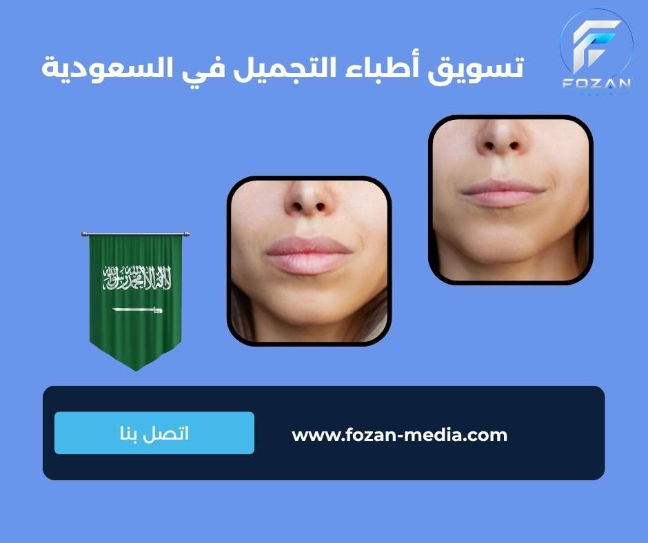 تسويق أطباء التجميل في السعودية 