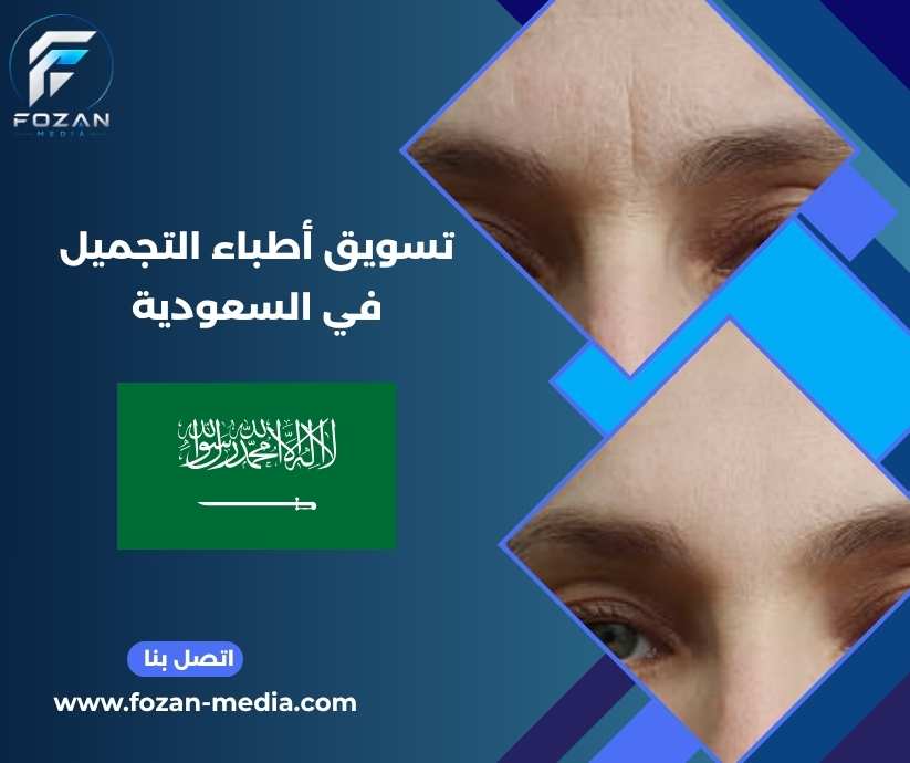 تسويق أطباء التجميل في السعودية