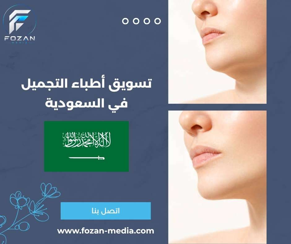 تسويق أطباء التجميل في السعودية 